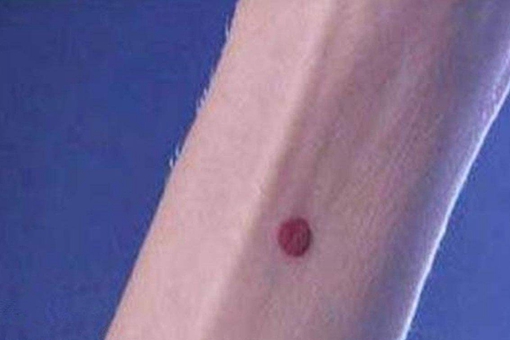 守宫砂是什么真的吗?守宫砂真正用处是什么? 守宫砂是什么真的吗?守宫砂真正用处是什么?