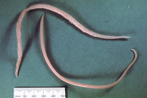 世界上第一位冷冻人是谁 是否已经解冻 世界上第一位冷冻人是谁 是否已经解冻